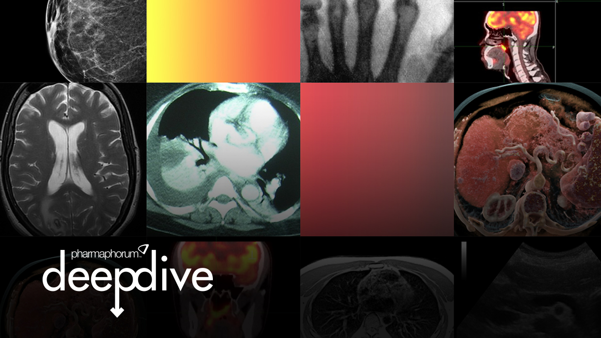 Timeline: a history of medical imaging
